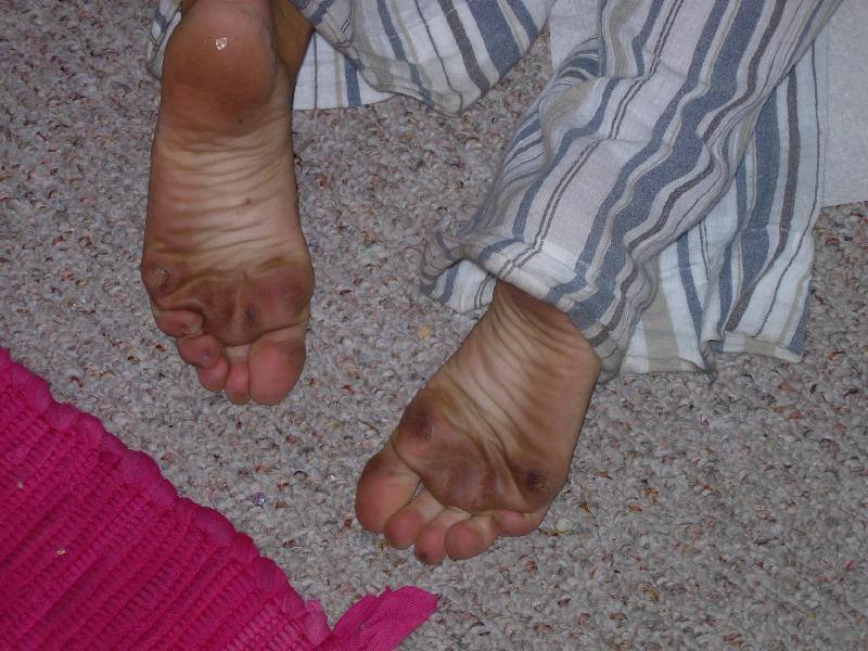 Pieds sales