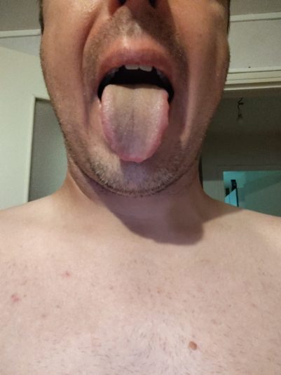 17201852198146993617736886265568