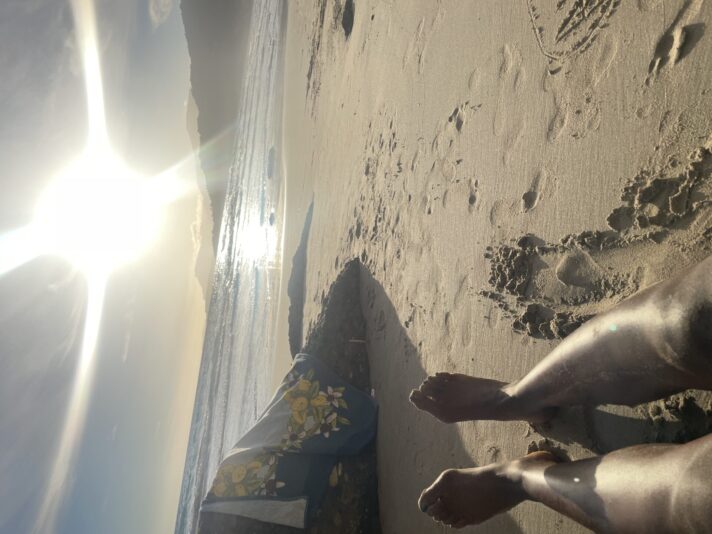 V bunion 🌞