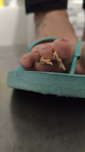 Laura en tongs et les nouveaux petits bonhommes 1