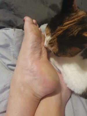 17739435469996911456488786836120