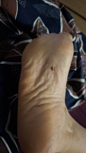 17657505028624866164720716205461